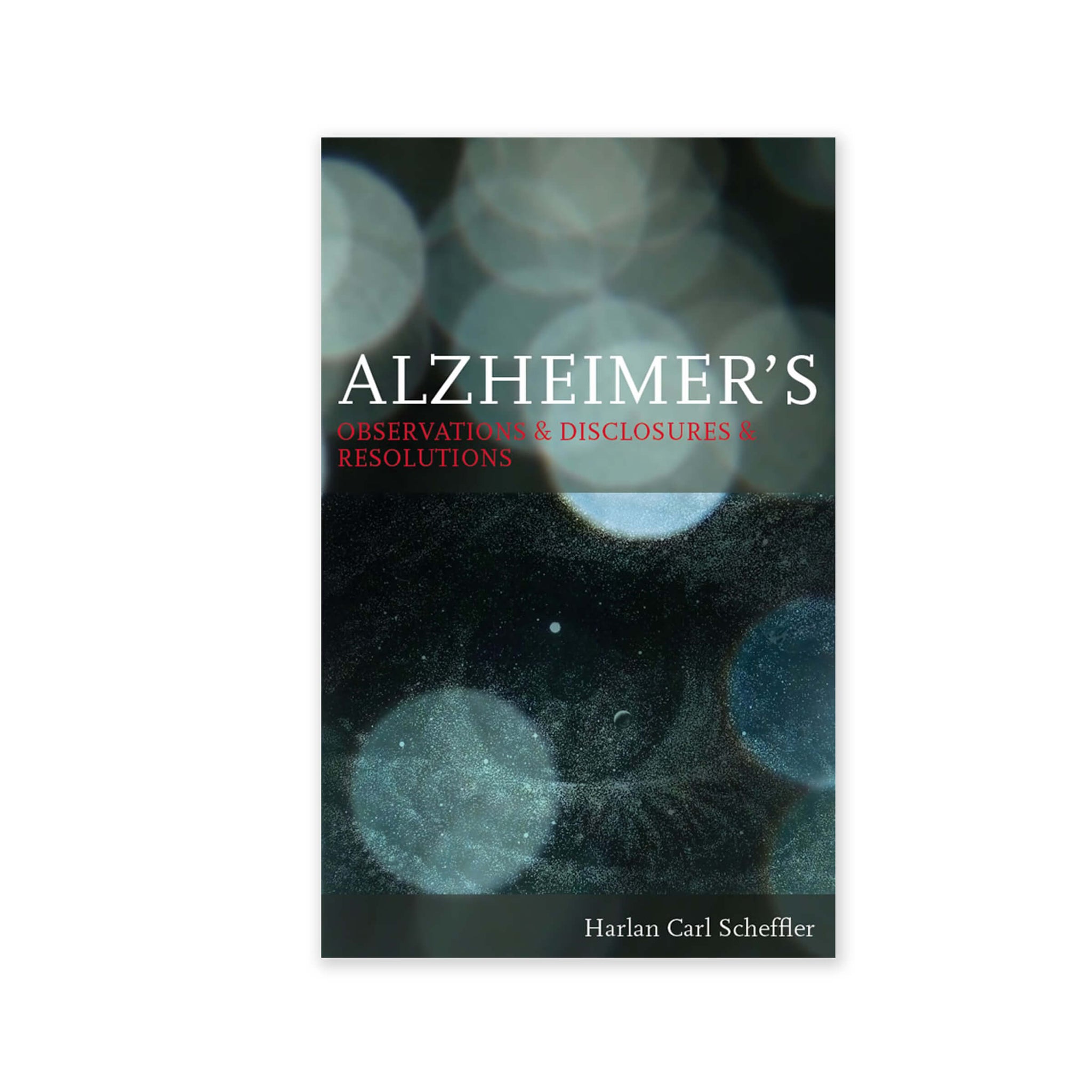 Alzheimers - Observations & Disclosures & Resolutions - (e-book £4.99)